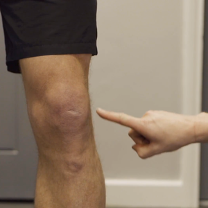 Runners Knee - Physio in the Park Tips